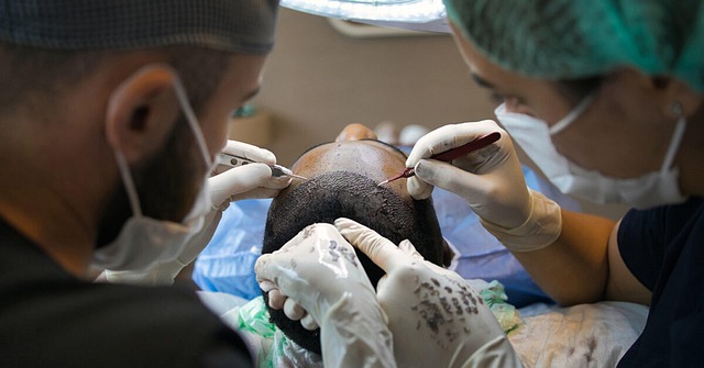 kosten haartransplantatie